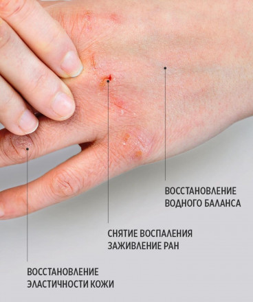 SMART   Бальзам для быстрого восстановления кожи  HEALING BALM   15мл